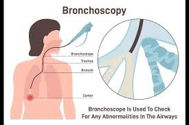 Bronboringproces